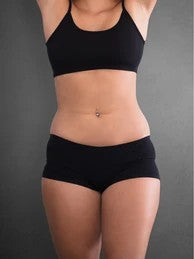 Before - Resultados que se sienten