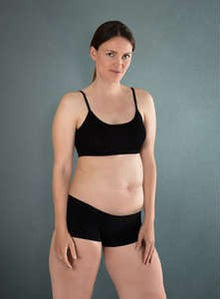 Before - Resultados que se sienten